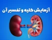 آزمایش عملکرد کلیه