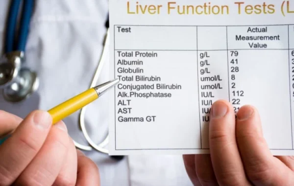 بیلی‌ روبین