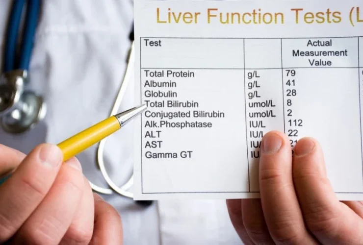 بیلی‌ روبین