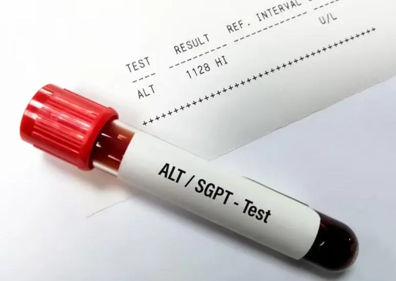 بالا بودن ALT