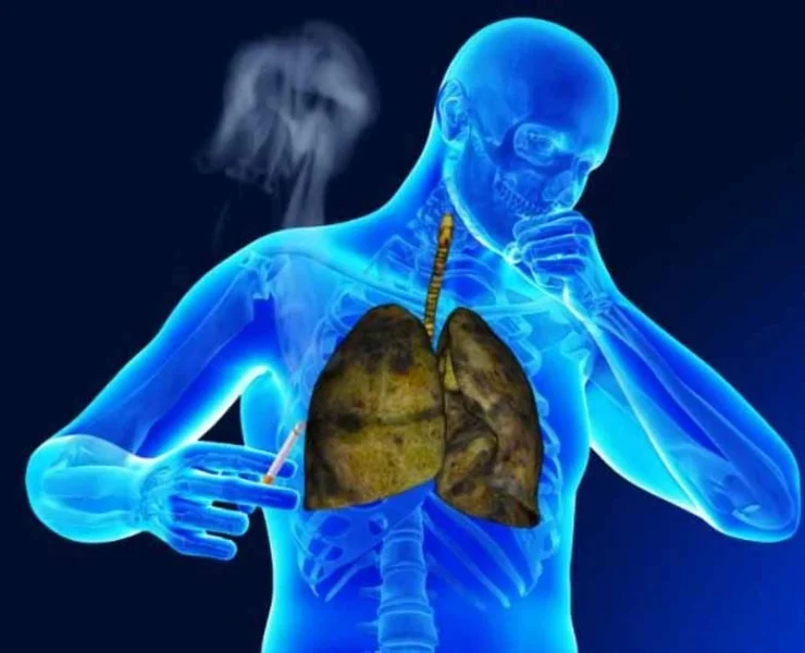 بیماری های تنفسی