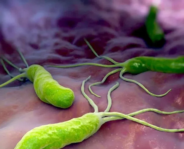 هلیکوباکتر پیلوری