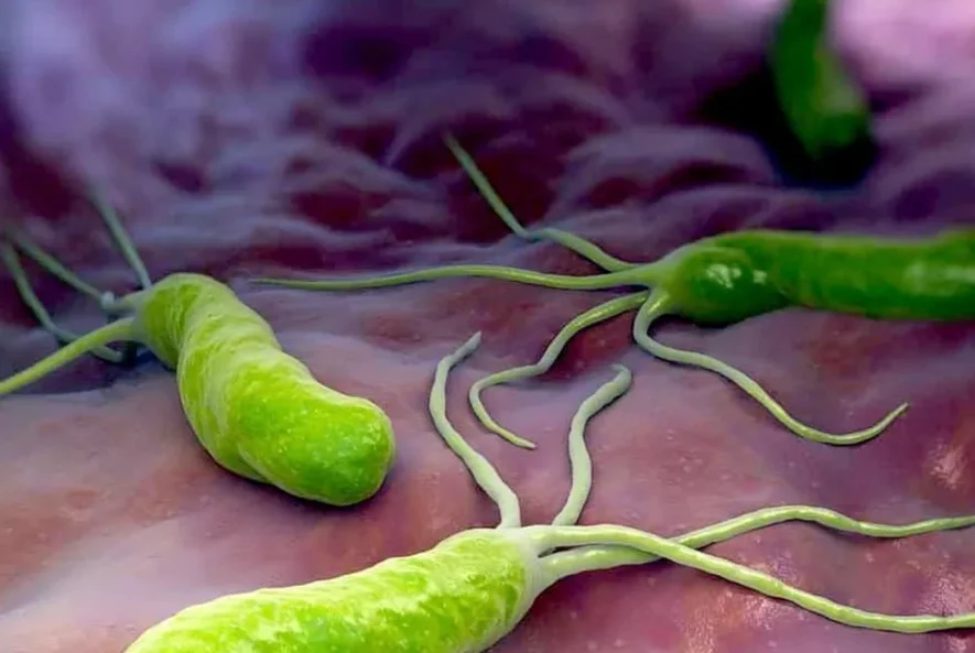 هلیکوباکتر پیلوری