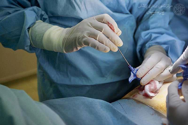 بیوپسی 1 بیوپسی