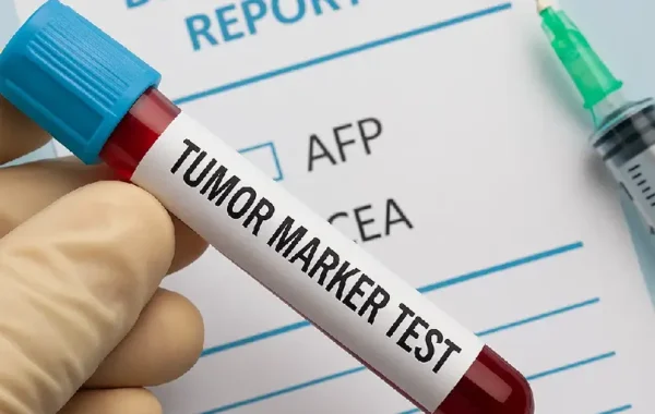 مارکرهای توموری