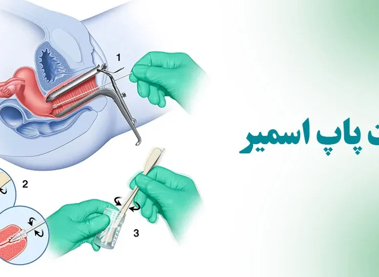 آزمایش پاپ اسمیر