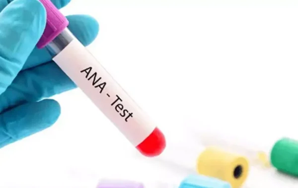 آزمایش ANA