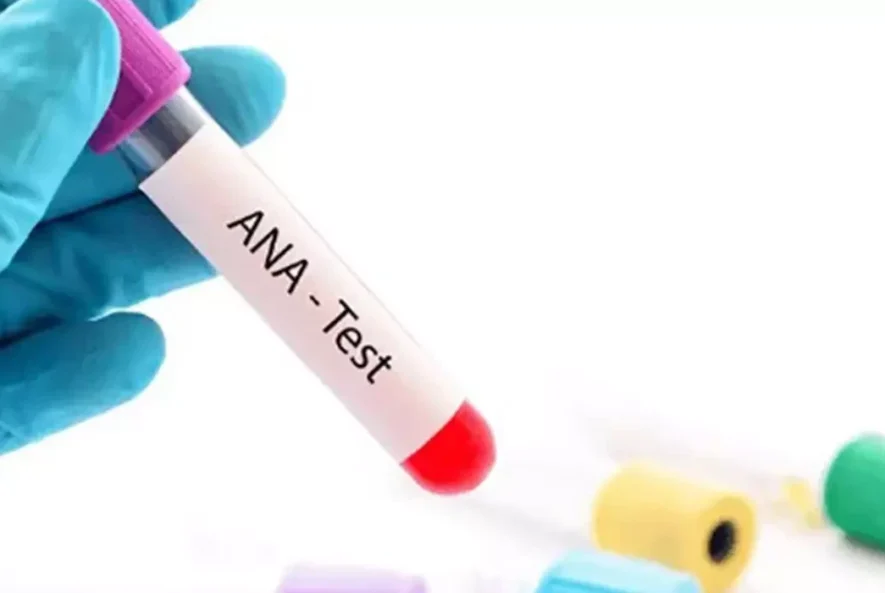 آزمایش ANA 1 آزمایش ANA